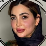 فیلر چانـه